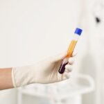 Eklem Sağlığında Modern Tedavi Yöntemleri prgf