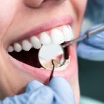 Fethiye’de Estetik Diş Hekimliği Hizmetleri fethiye diş hekimi (11)