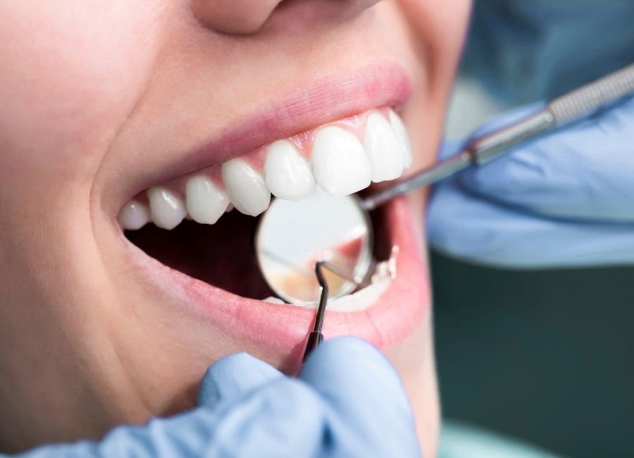 Fethiye’de Estetik Diş Hekimliği Hizmetleri